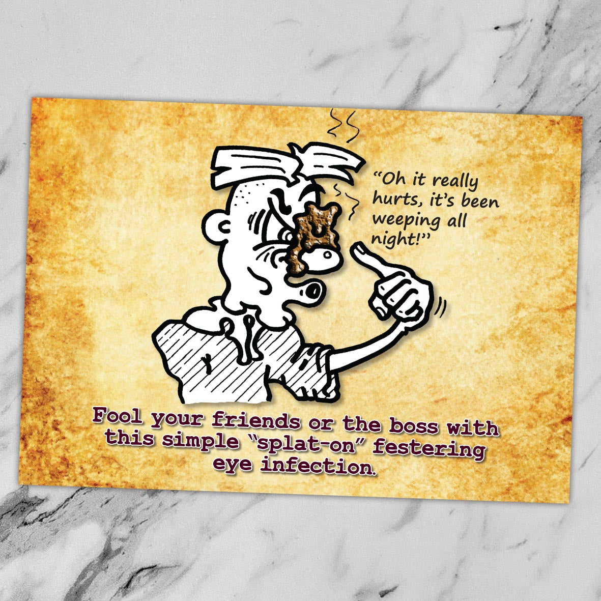 Eye Infection Cartoon Art Print