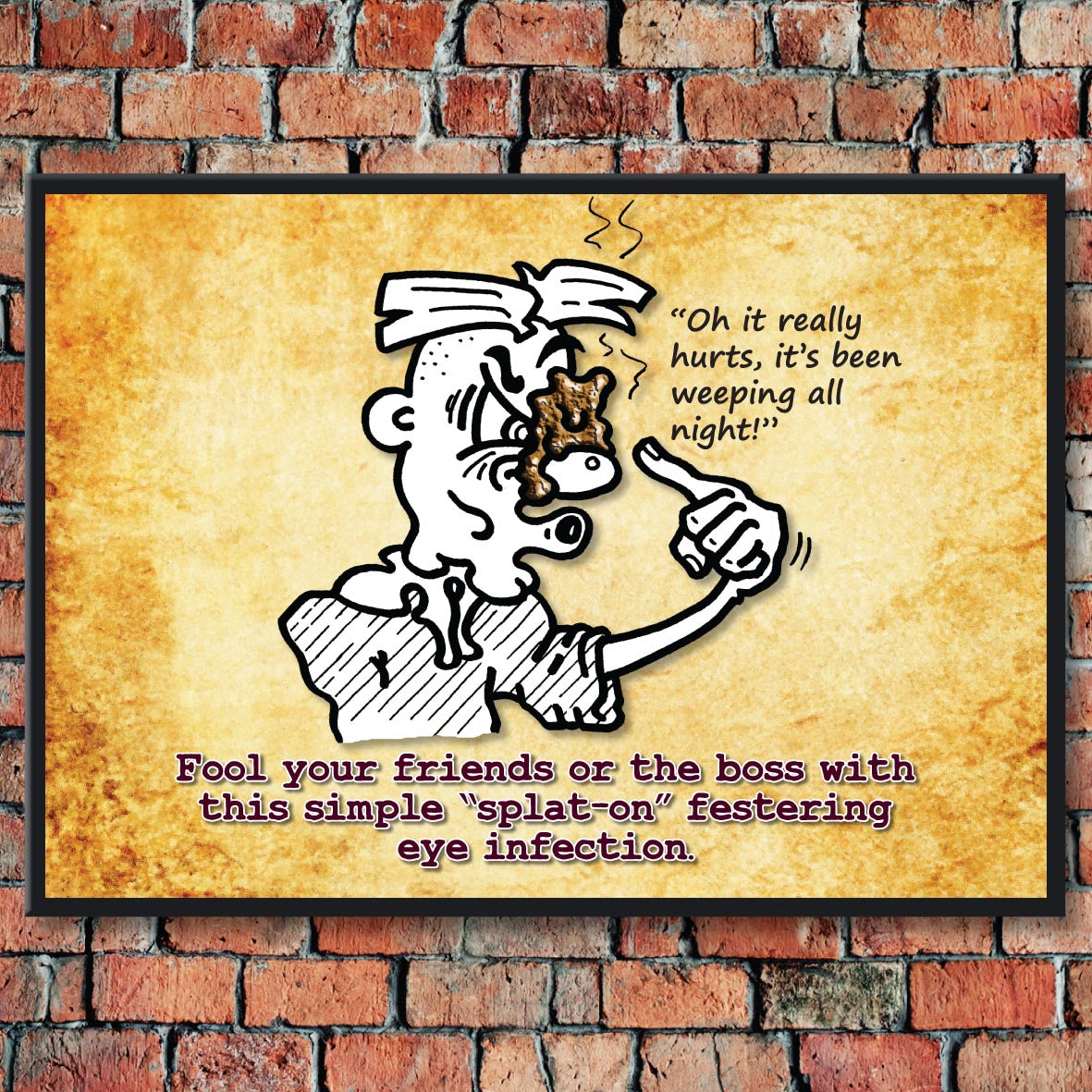 Eye Infection Cartoon Art Print