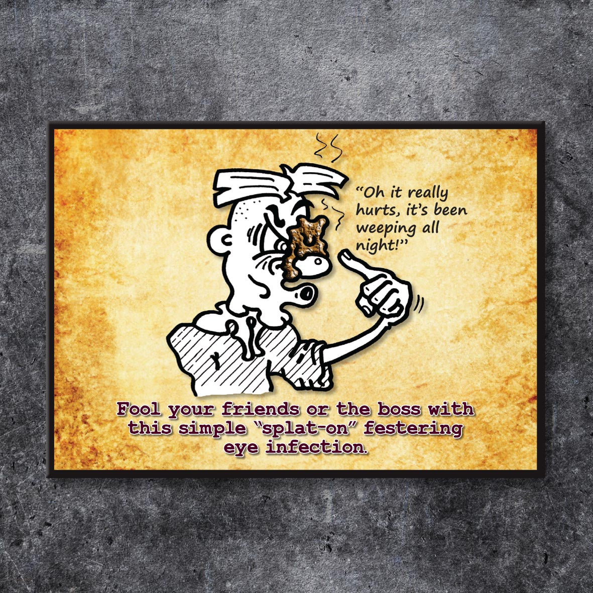 Eye Infection Cartoon Art Print