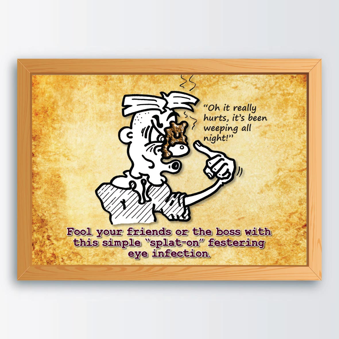 Eye Infection Cartoon Art Print