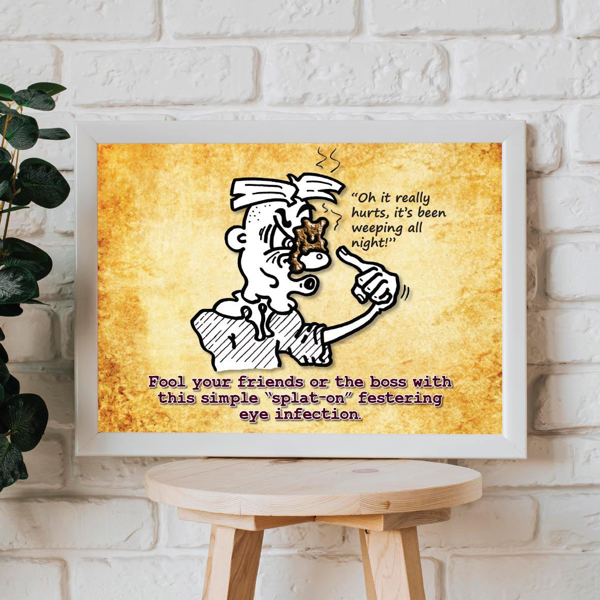 Eye Infection Cartoon Art Print